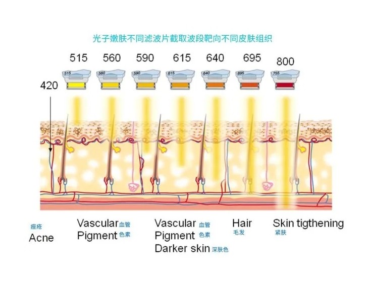 五大光子嫩膚技術(shù)（IPL、DPL、OPT、APT、BBL）及濾光片區別